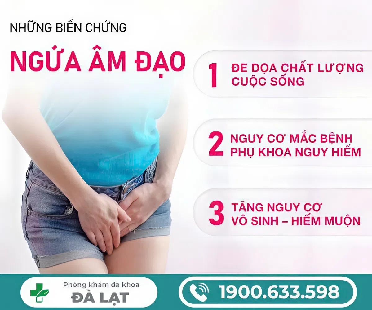 Hình ảnh minh họa